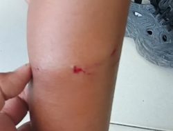VIRAL! Disanksi Ambil Air Gegara Terlambat, Siswa SD di Mamasa Digigit Anjing Beranak